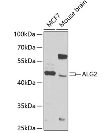 ALG2 Rabbit Polyclonal Antibody