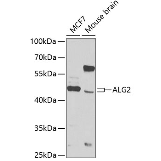 ALG2 Rabbit Polyclonal Antibody