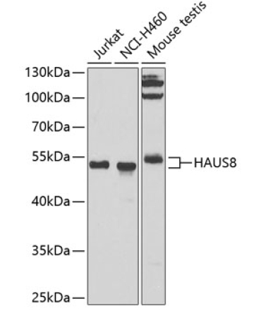 HAUS8 Rabbit Polyclonal Antibody