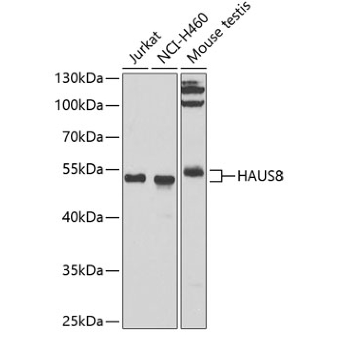 HAUS8 Rabbit Polyclonal Antibody