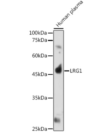 LRG1 Rabbit Polyclonal Antibody