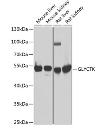 GLYCTK Rabbit Polyclonal Antibody