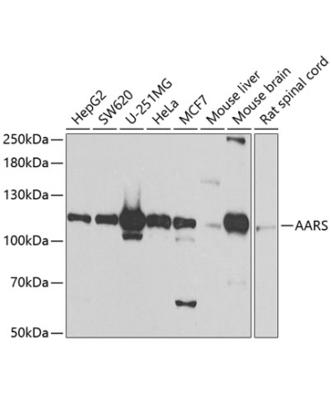 AARS Rabbit Polyclonal Antibody