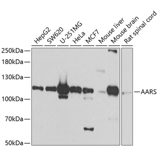 AARS Rabbit Polyclonal Antibody