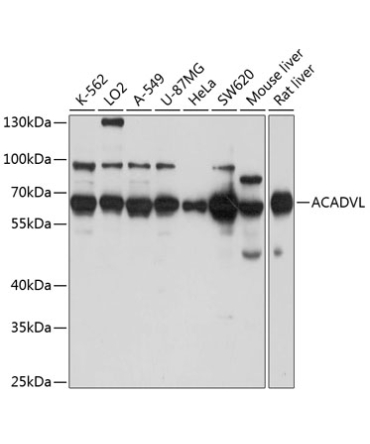 ACADVL Rabbit Polyclonal Antibody