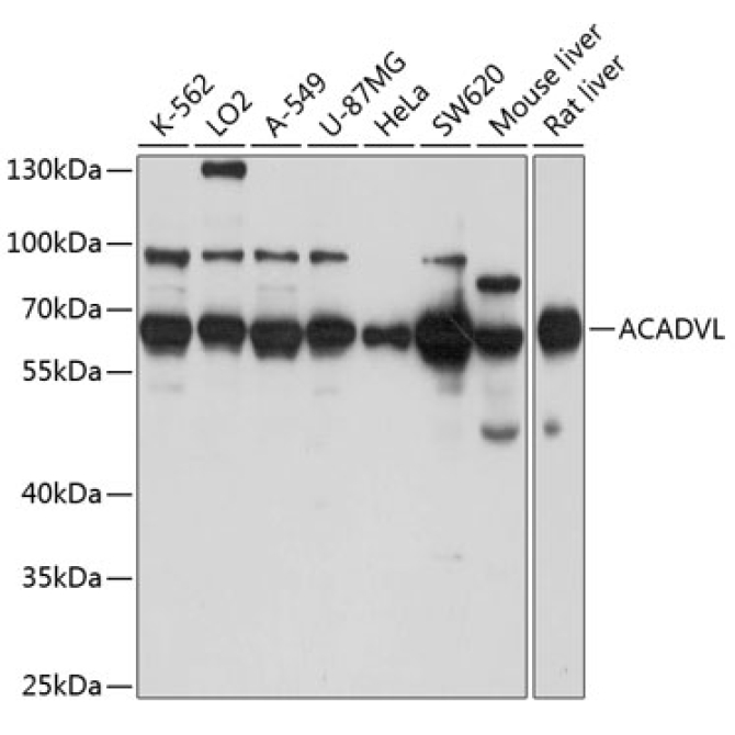ACADVL Rabbit Polyclonal Antibody