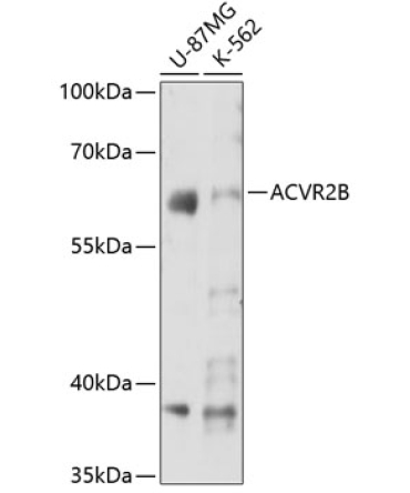 ACVR2B Rabbit Polyclonal Antibody
