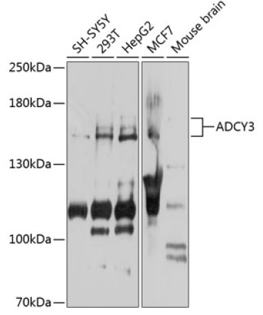 ADCY3 Rabbit Polyclonal Antibody