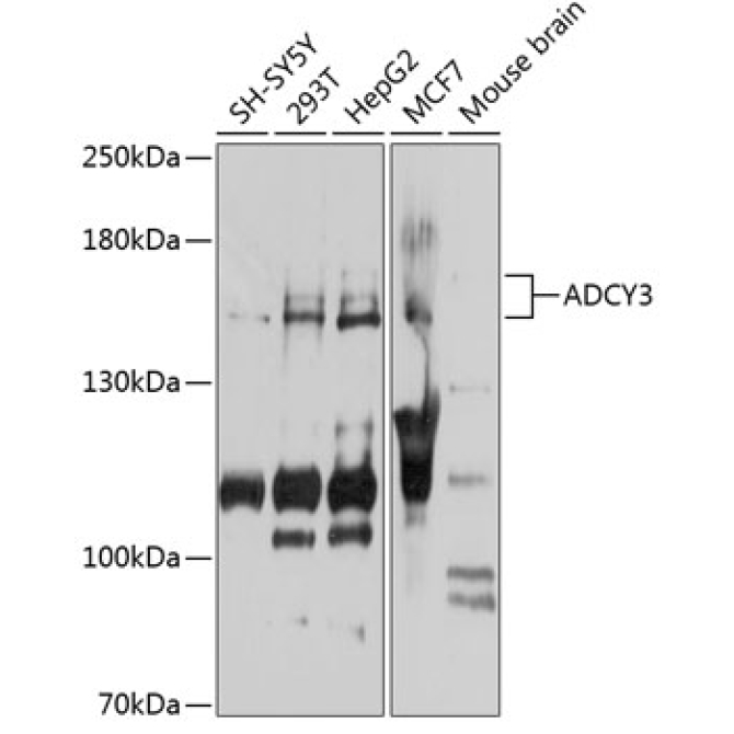 ADCY3 Rabbit Polyclonal Antibody