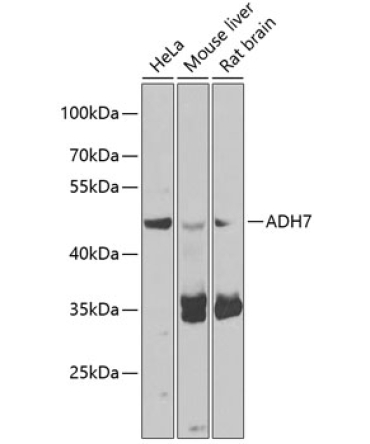 ADH7 Rabbit Polyclonal Antibody