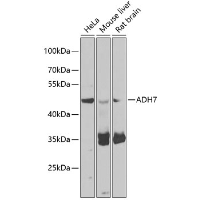 ADH7 Rabbit Polyclonal Antibody