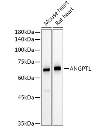 ANGPT1 Rabbit Polyclonal Antibody