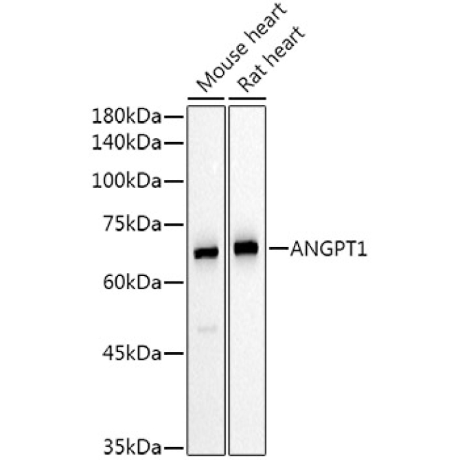ANGPT1 Rabbit Polyclonal Antibody