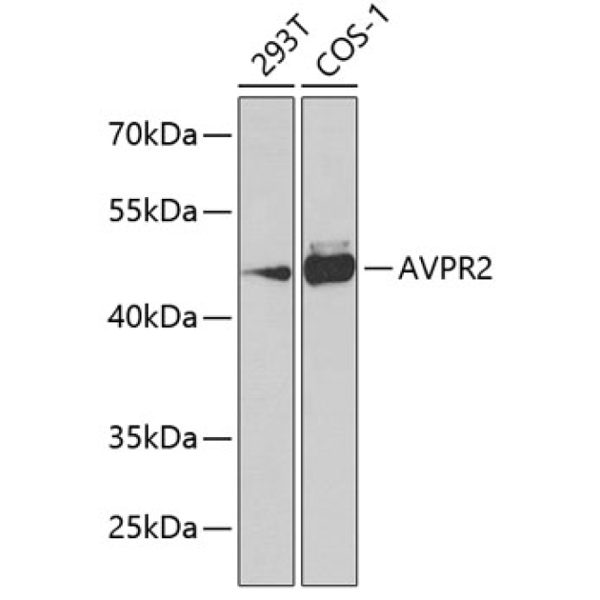 AVPR2 Rabbit Polyclonal Antibody