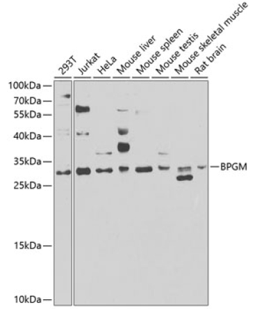 BPGM Rabbit Polyclonal Antibody