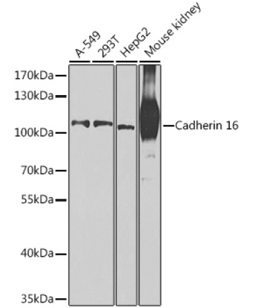 Cadherin 16 Rabbit Polyclonal Antibody