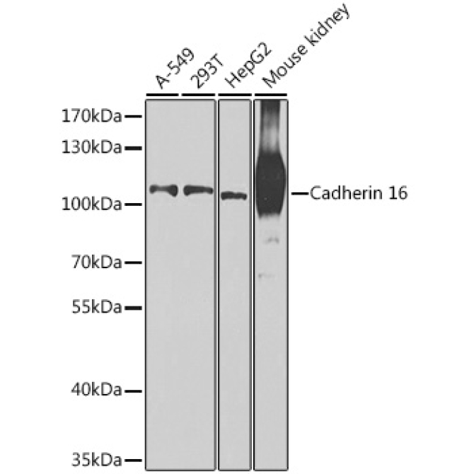 Cadherin 16 Rabbit Polyclonal Antibody