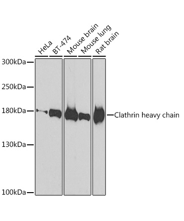 Clathrin heavy chain Rabbit Polyclonal Antibody