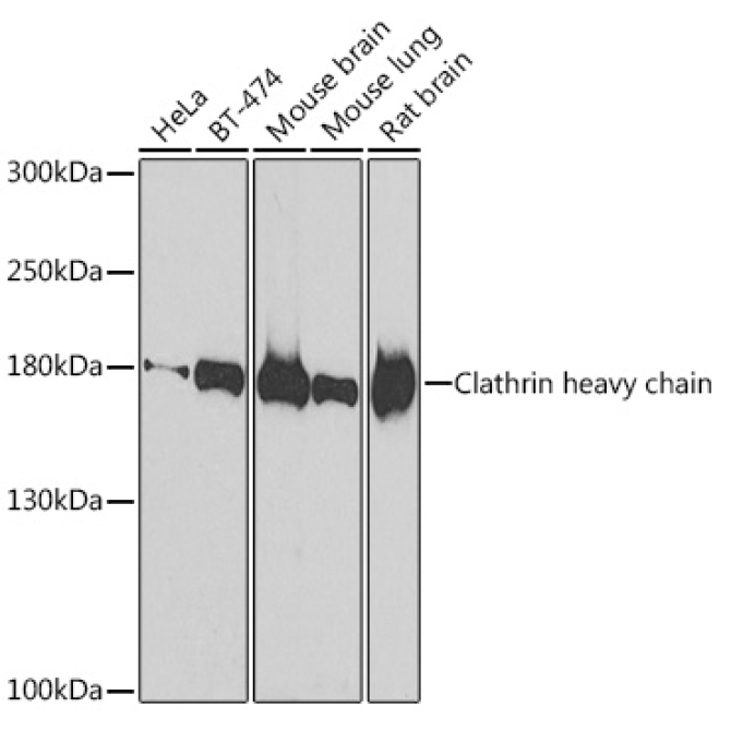 Clathrin heavy chain Rabbit Polyclonal Antibody