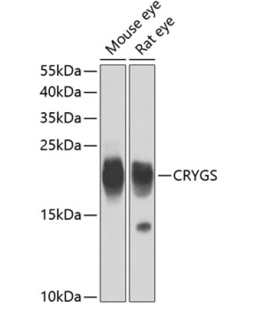 CRYGS Rabbit Polyclonal Antibody