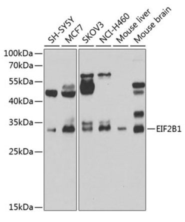 EIF2B1 Rabbit Polyclonal Antibody