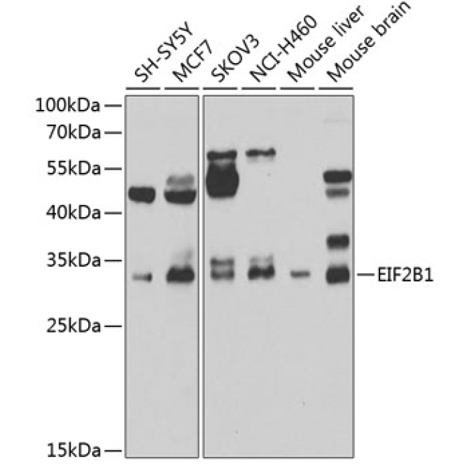 EIF2B1 Rabbit Polyclonal Antibody