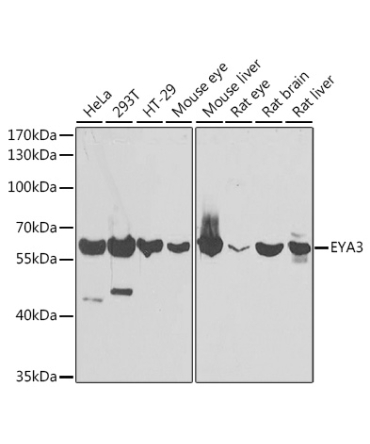 EYA3 Rabbit Polyclonal Antibody