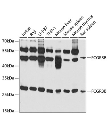 FCGR3B Rabbit Polyclonal Antibody