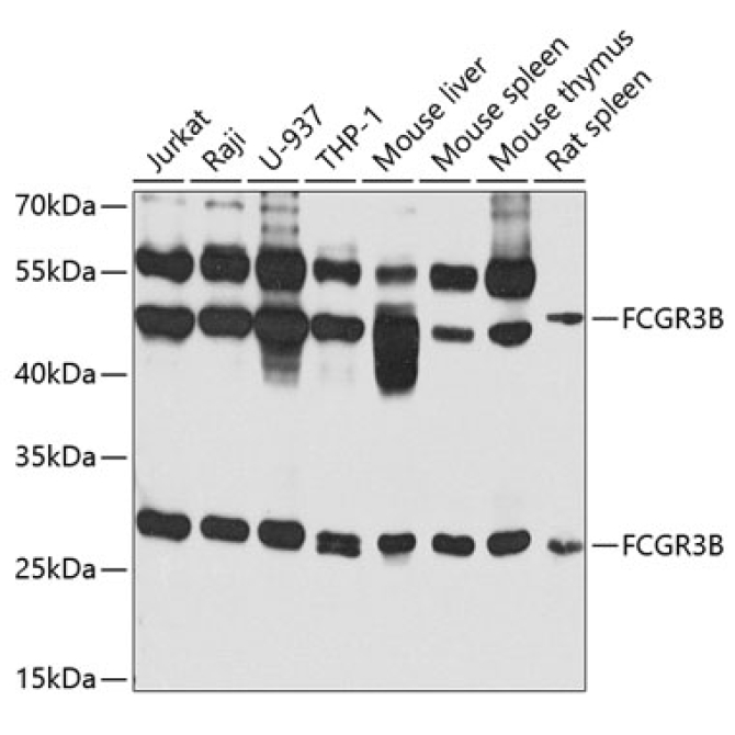 FCGR3B Rabbit Polyclonal Antibody