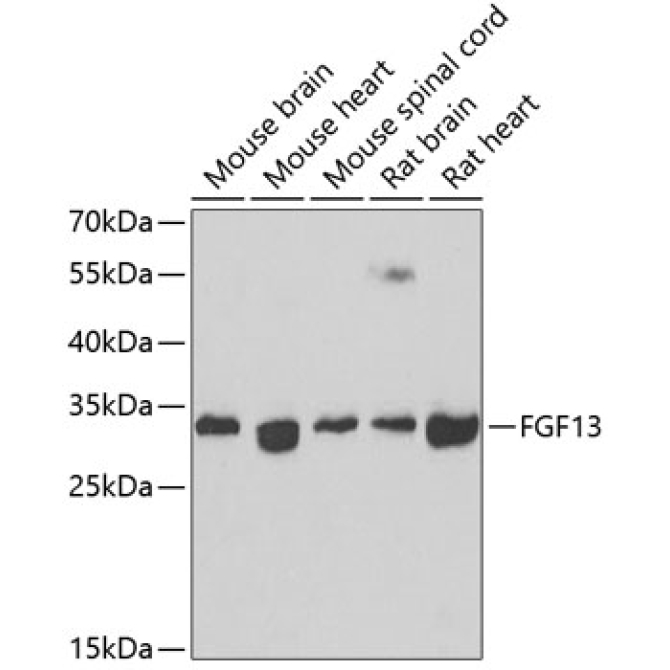 FGF13 Rabbit Polyclonal Antibody