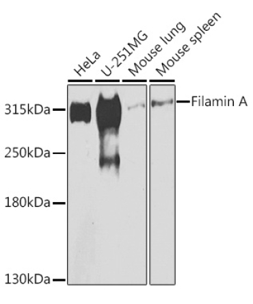 Filamin A Rabbit Polyclonal Antibody