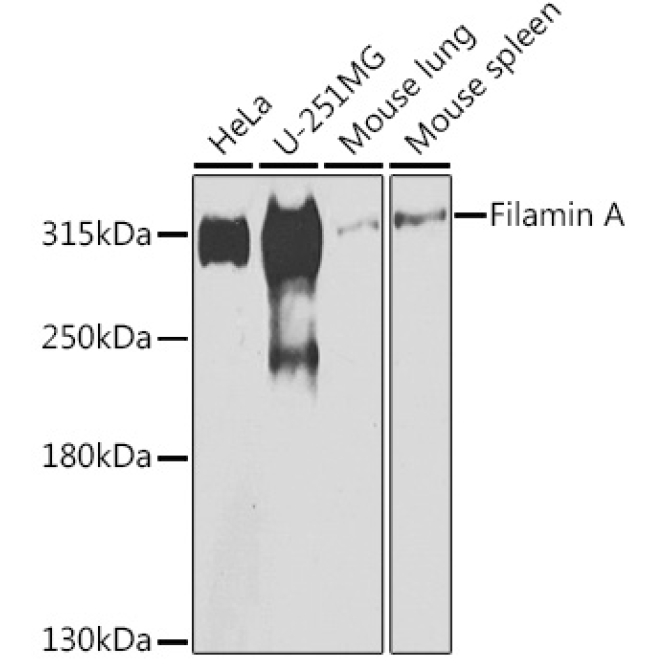 Filamin A Rabbit Polyclonal Antibody
