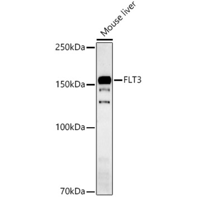 FLT3 Rabbit Polyclonal Antibody