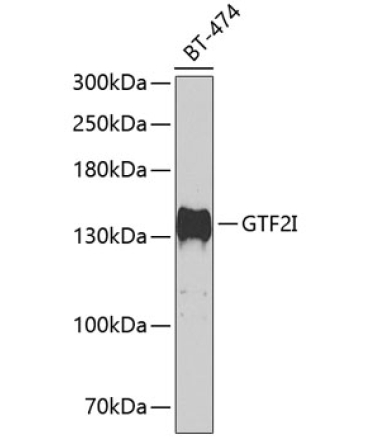 GTF2I Rabbit Polyclonal Antibody