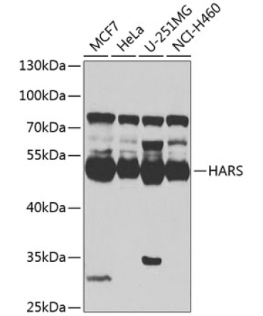 HARS Rabbit Polyclonal Antibody