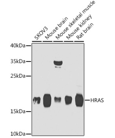 HRAS Rabbit Polyclonal Antibody