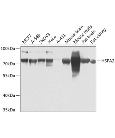 HSPA2 Rabbit Polyclonal Antibody