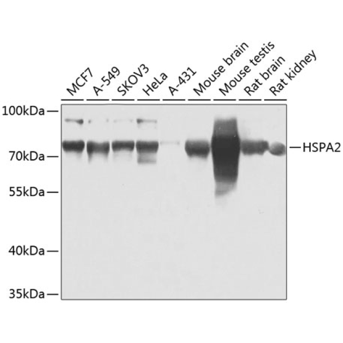 HSPA2 Rabbit Polyclonal Antibody