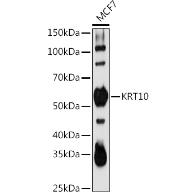 KRT10 Rabbit Polyclonal Antibody