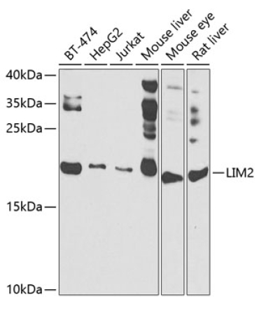 LIM2 Rabbit Polyclonal Antibody