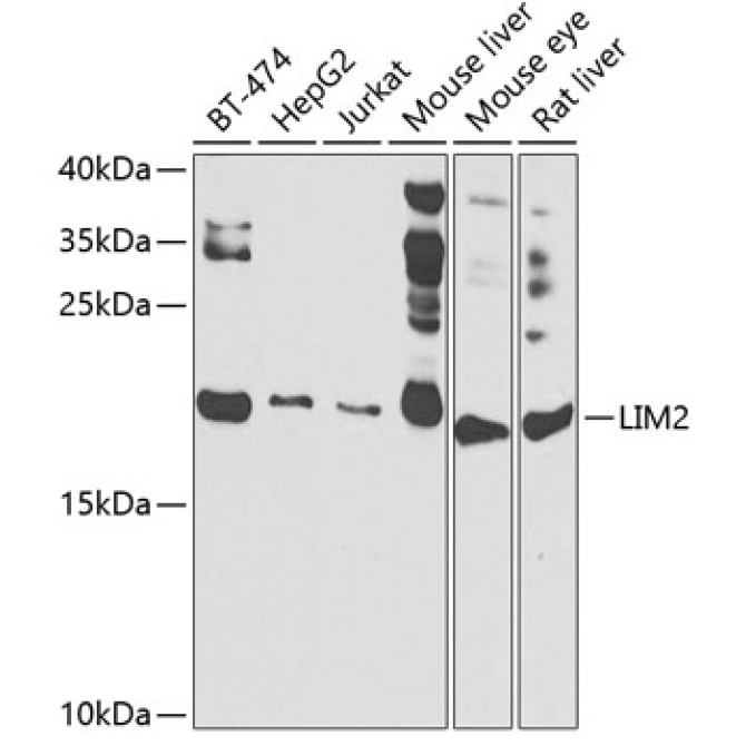 LIM2 Rabbit Polyclonal Antibody