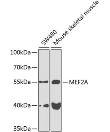 MEF2A Rabbit Polyclonal Antibody