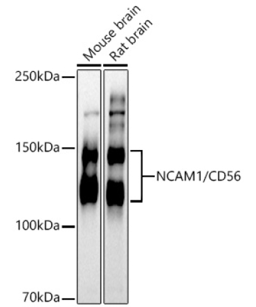 NCAM1 / CD56 Rabbit Polyclonal Antibody