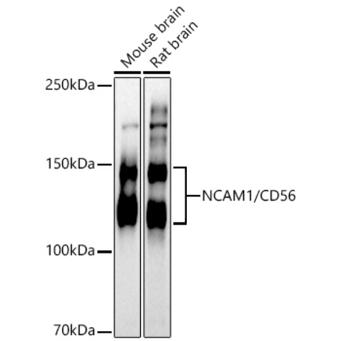NCAM1 / CD56 Rabbit Polyclonal Antibody
