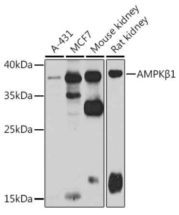 AMPKBeta1 Rabbit Polyclonal Antibody