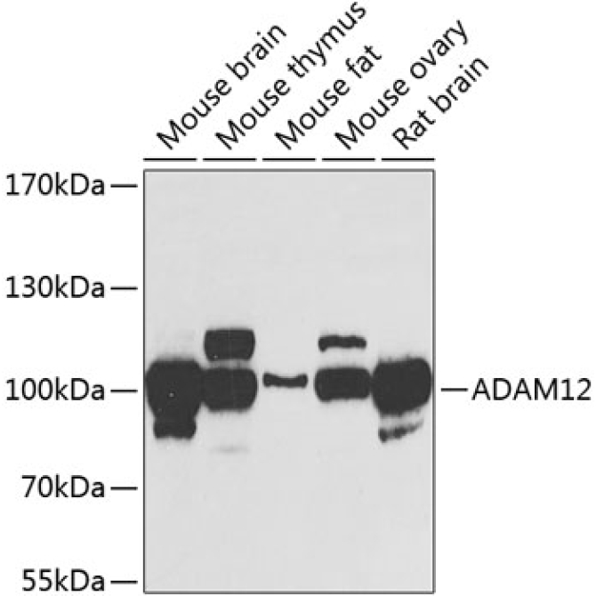 ADAM12 Rabbit Polyclonal Antibody