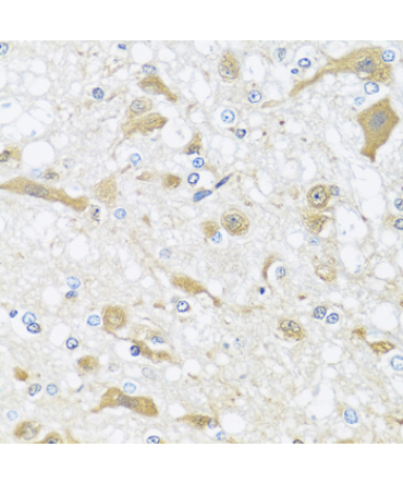 APOL1 Rabbit Polyclonal Antibody