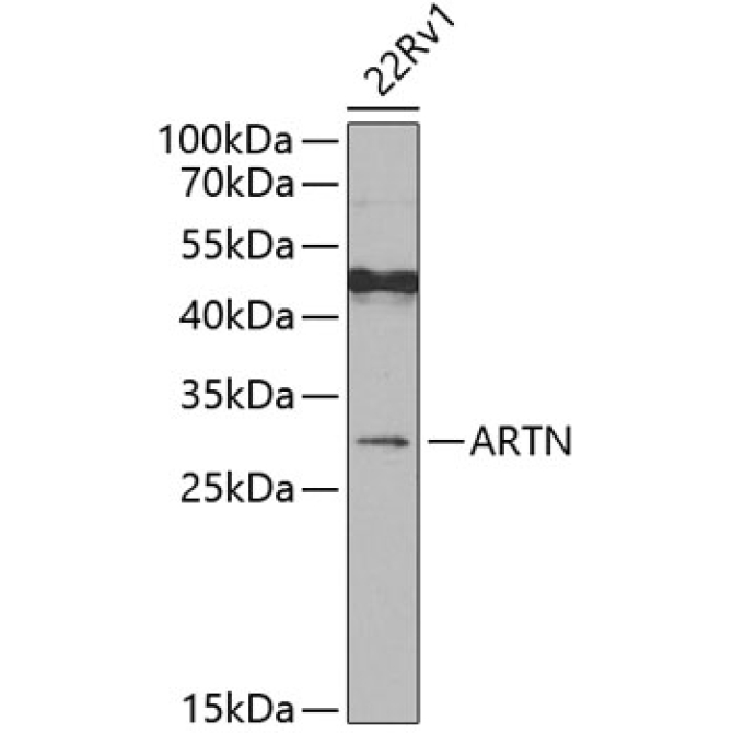 ARTN Rabbit Polyclonal Antibody