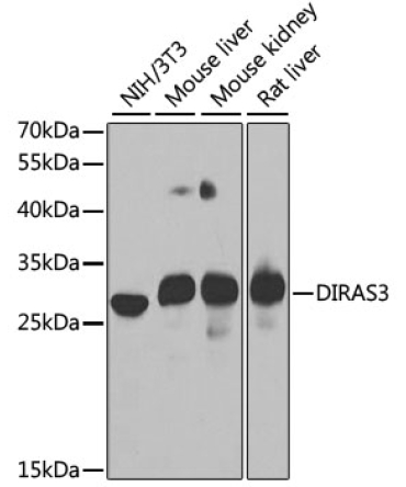 DIRAS3 Rabbit Polyclonal Antibody