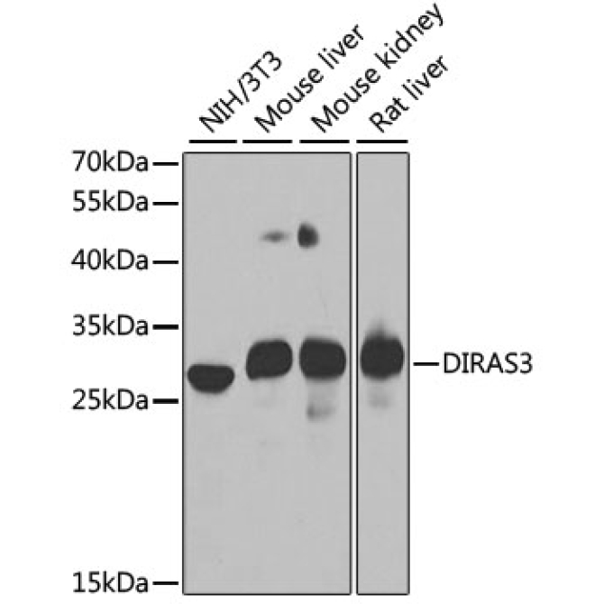 DIRAS3 Rabbit Polyclonal Antibody